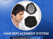 Non-Surgical-Hair-Replacement-System